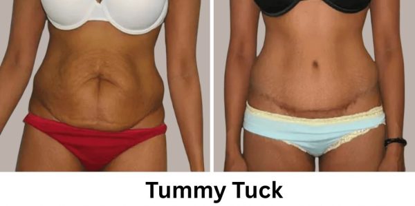 Plastic Surgery Westchester Results