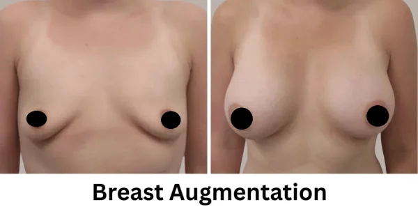 Plastic Surgery Westchester Results