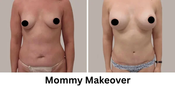 Plastic Surgery Westchester Results