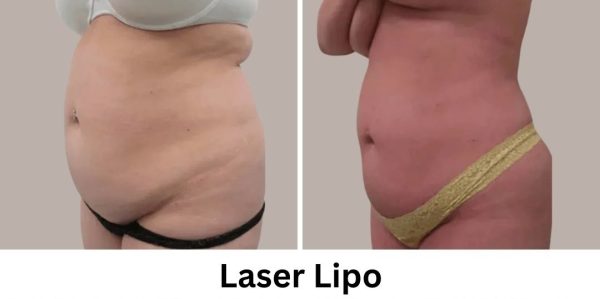 Plastic Surgery Westchester Results