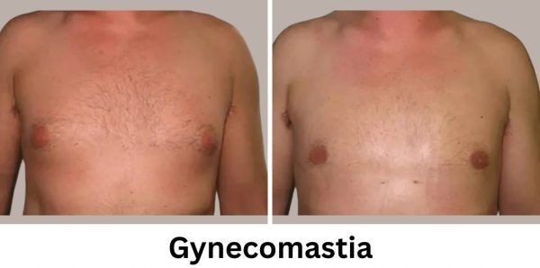 Plastic Surgery Westchester Results