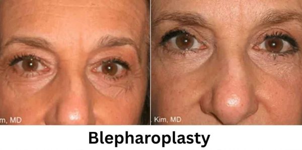 Plastic Surgery Westchester Results